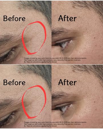 New Facial Serum for Sensitive Skin,Vitamin C, Hyaluronic Acid & Niacinamide, Hydrating Anti-Aging Formula 1 fl oz (30 ml)