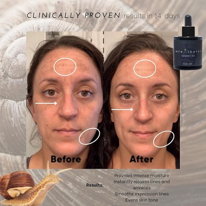 Intoxicated Cosmetics Snail Serum - Luxurious Anti-Aging Skin Care with XEP-018 and Hyaluronic Acid for Extreme Lifting, Hydration and Regeneration
