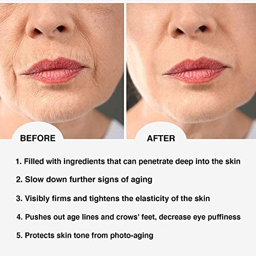DermaSet Anti-Aging Renewal Cream (NEW FORMULA) with Plant-Based Stem Cells Advanced Formula to Visibly Reduce Wrinkles, Fine Lines and Crow's Feet Instantly (1)