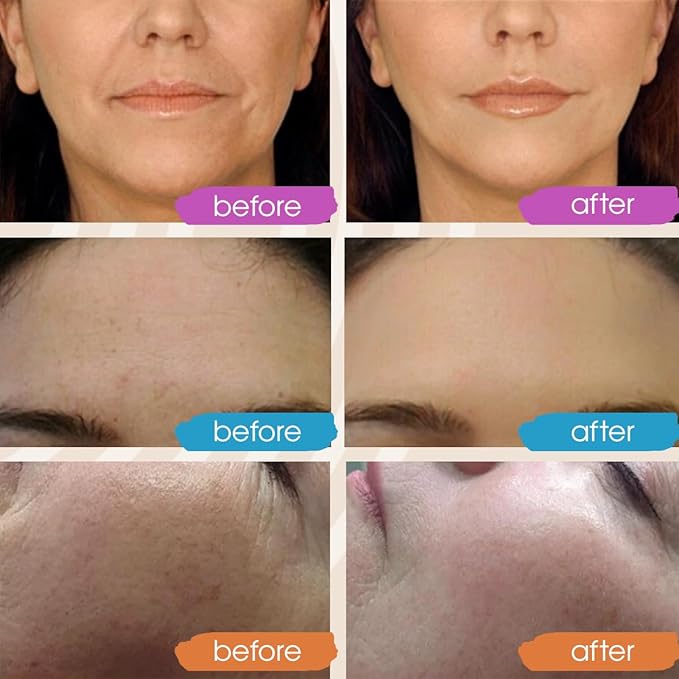 GLEOW New 2024 Pure Hyaluronic Acid Serum for Face - Hydrating Serum for Women - Hyaluronic Acid Pure Face Serum for Women - Face Serum for Dry Skin with Dark Spots 2oz