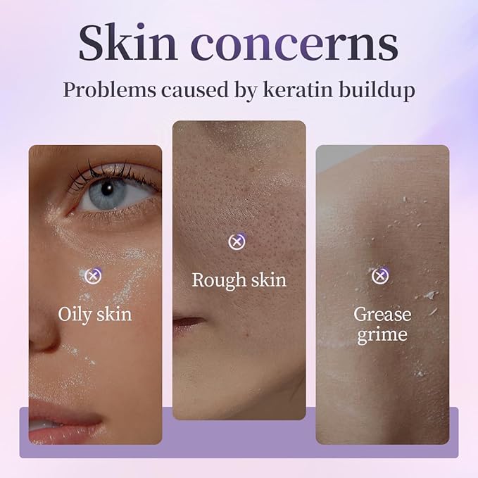 AHA BHA Exfoliating Gel, Deep Cleansing Peeling Gel for Acne Prone Skin, Removes Dead Skin Cells, Minimizes Pores, Renews Skin, Facial & Body Scrub, 2.03 fl oz