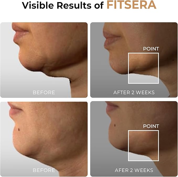 Aalok Fitsera | Near-Infrared Red Light Home Facial Device for Firming, Skin Rejuvenation