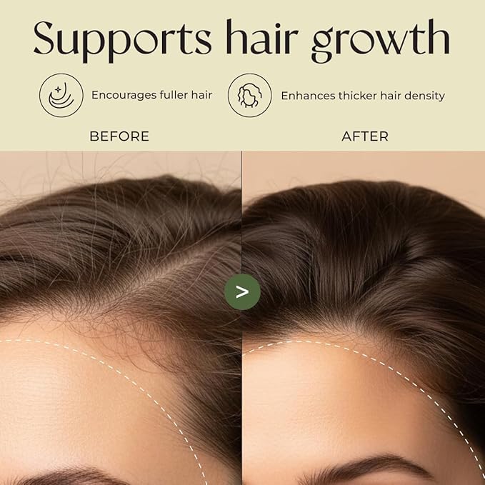Gya Labs Rosemary & Castor Hair Oil - 4 Fl Oz - for Scalp Health, Strengthens & Protection from Damage