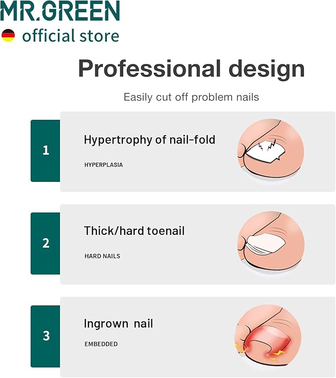 MR.GREEN Toenail Clippers Stainless Steel Ingrown Nail Cutter Thick and Hard Nails Pedicure Manicure Tools (Green+Nail Remover)