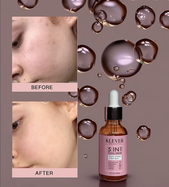Anti-Aging Face Serum with Hyaluronic Acid, Vitamin C, Collagen, Niacinamide & Vitamin E – Hydrating Facial Treatment for all skin types – KLEVER Beauty, 30 ml