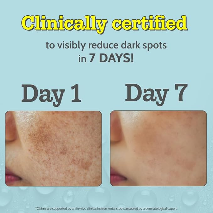 Chemist At Play Vitamin C Face Serum | Lightweight Daily Serum for Skin Care Routine | 30ml