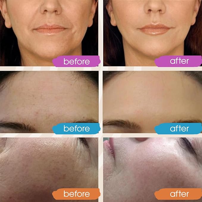 GLEOW Retinol Serum for Face, Vitamin C with Hyaluronic Acid Face Serum for Women and Men, Glow Skin Care Set Total Package Targets Appearance of Uneven Skin Tone and Dryness 3x1oz