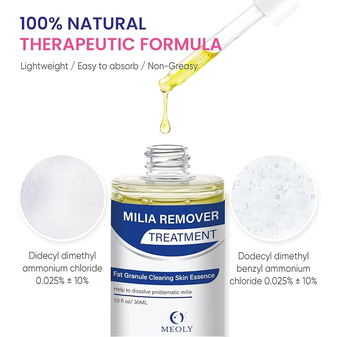 Milia Remover treatment serum, Milia Spot Treatment with Salicylic Acid Milia Acne Serum 25 ML