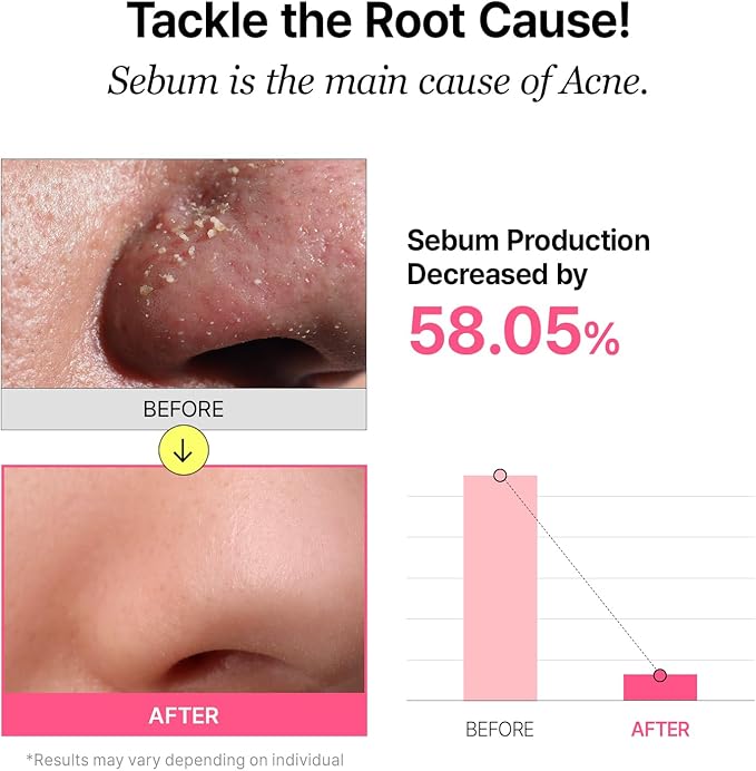 Pore Refining Toner Pad for All Skin Types, Sebum Control, Tighten Pores, Korean Skin Care, Vegan (70 Pads)