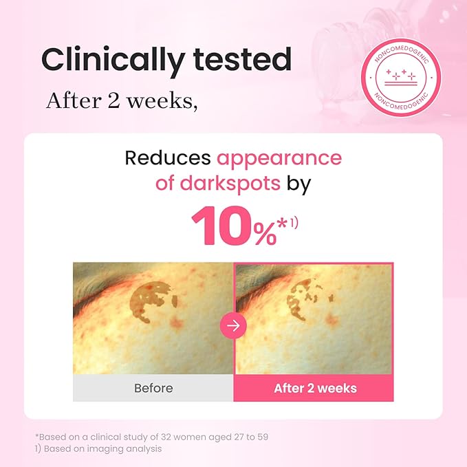 CNP PDRN + Tranexamic Acid Serum 15%, Pink Toning Skin Booster, Niacinamide & Micro-spicules, for Glass Skin, Korean Skin Care, 1. 01 fl. oz.