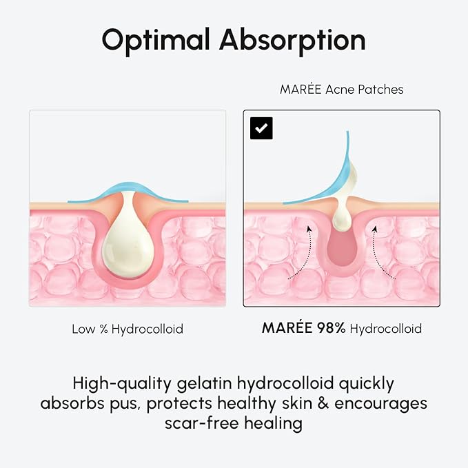 MAREE Invisible Pimple Patches - Clear Pimple Patches for Face - Hydrocolloid Acne Patches Anti Blemish - Zit Stickers for Face - Parches Para Acne - Pinple Zit Patches Pimple Stickers - 72 Dots