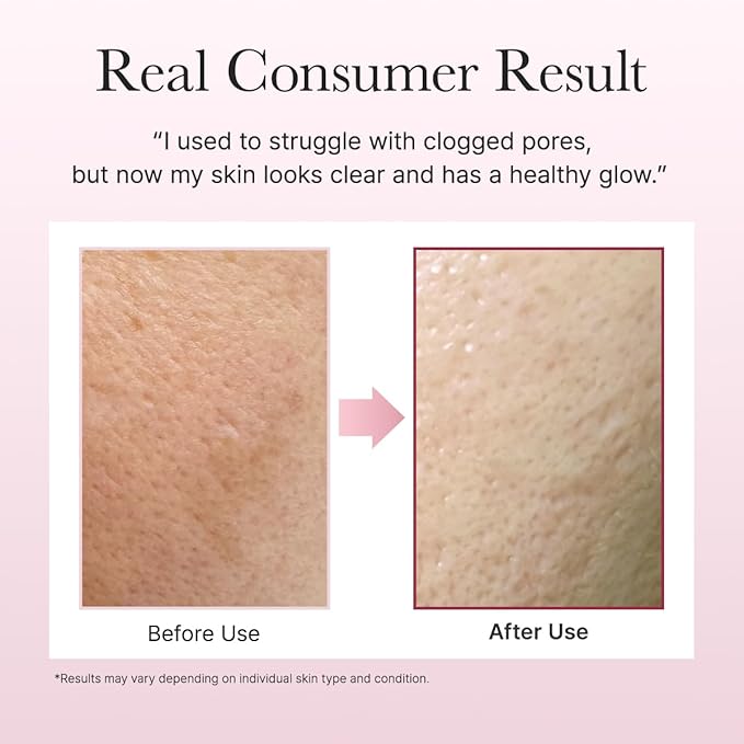 Arencia Rosehip Brightening Rice Mochi Face Cleanser & Daily Scrub - Moisturizing, Exfoliating & Deep-Cleansing - All Skin Types with Rice Powder & Rice Water (4.23oz)