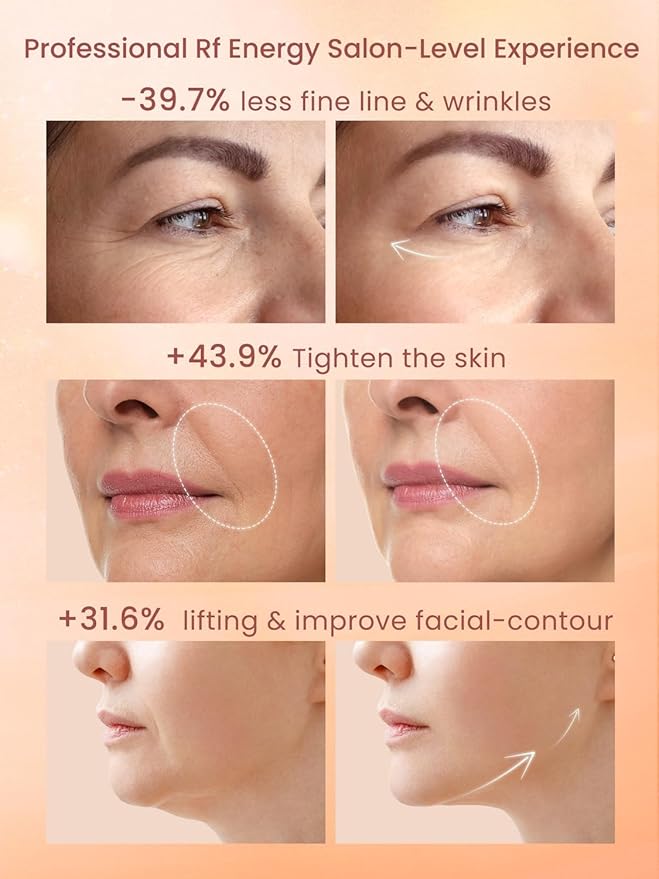 Radio Frequency Skin Tightening Device, RF Face Machine for Anti-Aging, Wrinkle Reduction & Jawline Lifting, Professional Wireless Home Use with 3 Levels