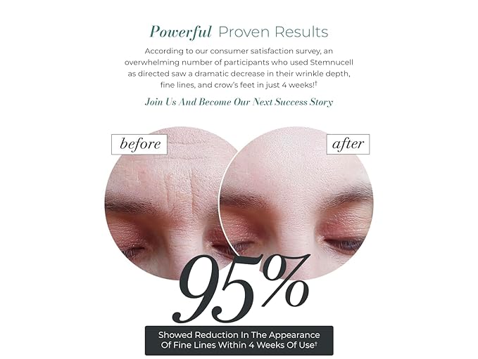 Solvaderm Stemnucell Anti-Aging Facial Serum – Reduces Wrinkles, Fine Lines & Expression Lines – Plant Stem Cells, Peptides & Hyaluronic Acid – Firming, Hydrating Cream for All Skin Types