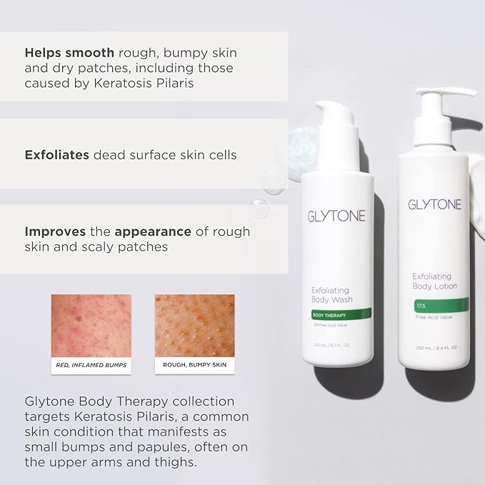 Glycolic Acid Body Wash – Exfoliating & Moisturizing Body Wash for Dry Skin, Reduce Keratosis Pilaris – Fragrance-Free Exfoliator with Glycolic Acid for Rough & Bumpy Skin, 6.7 Fl Oz