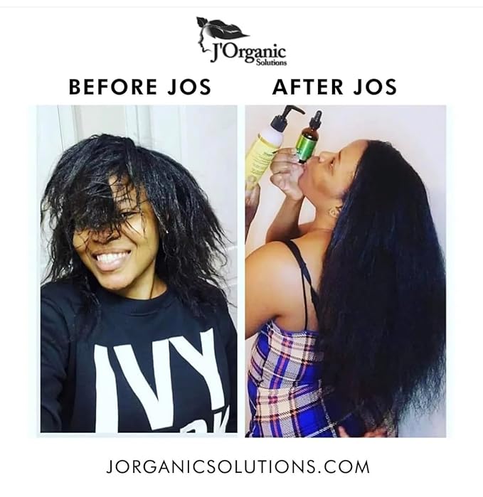 J'Organic Solutions Growth-Plus Scalp Nourishing Oil – Natural Hair Serum for Thicker Edges & Healthy Scalp (2 oz)