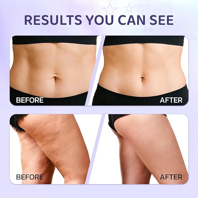 MYTH-Dreamy Overnight Toning Whip Firming Cellulite Cream, Skin Firming and Tightening Lotion While You Sleep - Helps Tighten Loose Skin & Cellulite on Belly, Booty, Arms & Thighs, with Gua Sha Tool