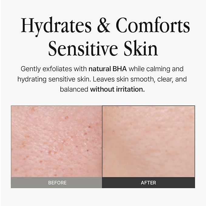 Skin 320ml