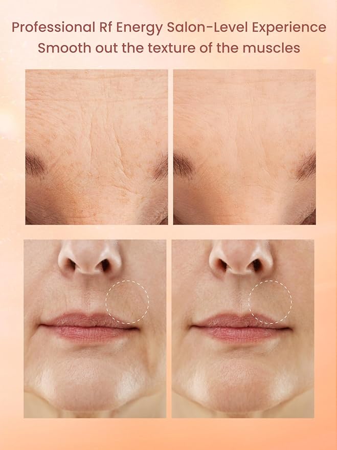 Radio Frequency Skin Tightening Device, RF Face Machine for Anti-Aging, Wrinkle Reduction & Jawline Lifting, Professional Wireless Home Use with 3 Levels