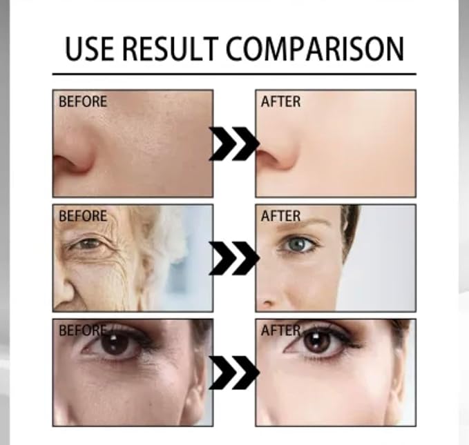 Snail Mucin 96.3% Serum with 92% Snail Mucin Cream Face Moisturizer Hydrating Serum For Face All Skin Types Skin Care