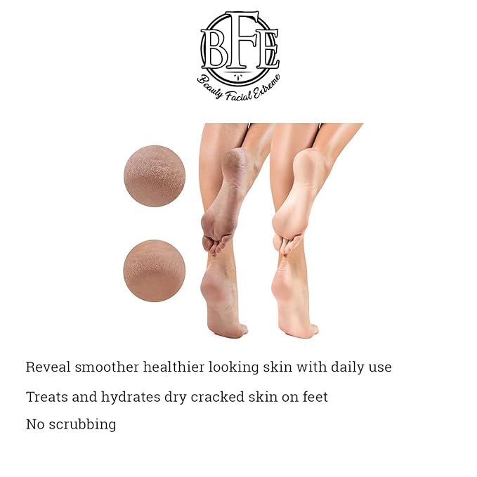 Keratosis Pilaris Exfoliating Body Lotion– 12% Lactic Acid. Provides Immediate Moisture & Gentle Exfoliation to Treat symptoms Associated with Keratosis Pilaris (KP) & Dry, Bumpy Skin Conditions.