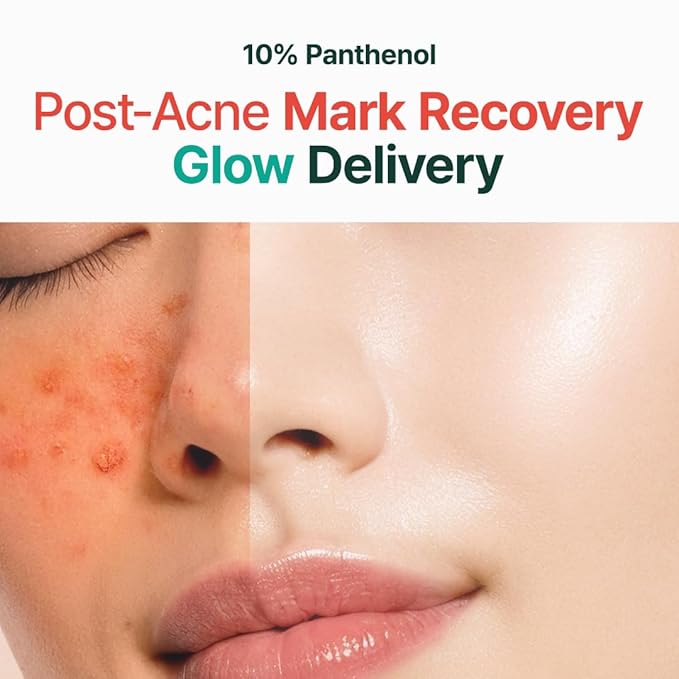 PURITO Post-Acne Moisturizer, Recovery & Glow Boost, Silicone-Free, Non-Comedogenic, Vegan, Korean Skincare, Mighty Bamboo Panthenol Cream, 3.38 fl oz / 100ml