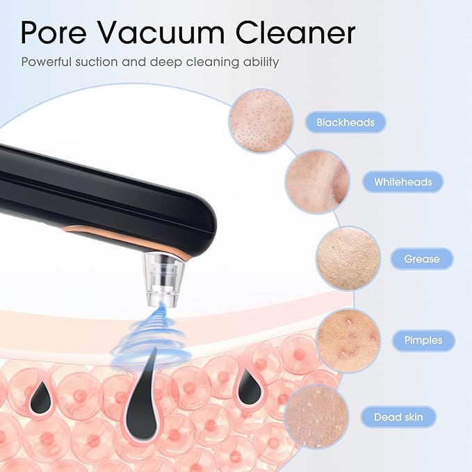 Yccu Blackhead Remover Vacuum Pore Extractor Black Head Remover for Face and Nose Blackhead Extractor Tool Pore Cleane Vacuum with USB Charge 4 Modes 5 Suction Heads for Women and Men (Black)