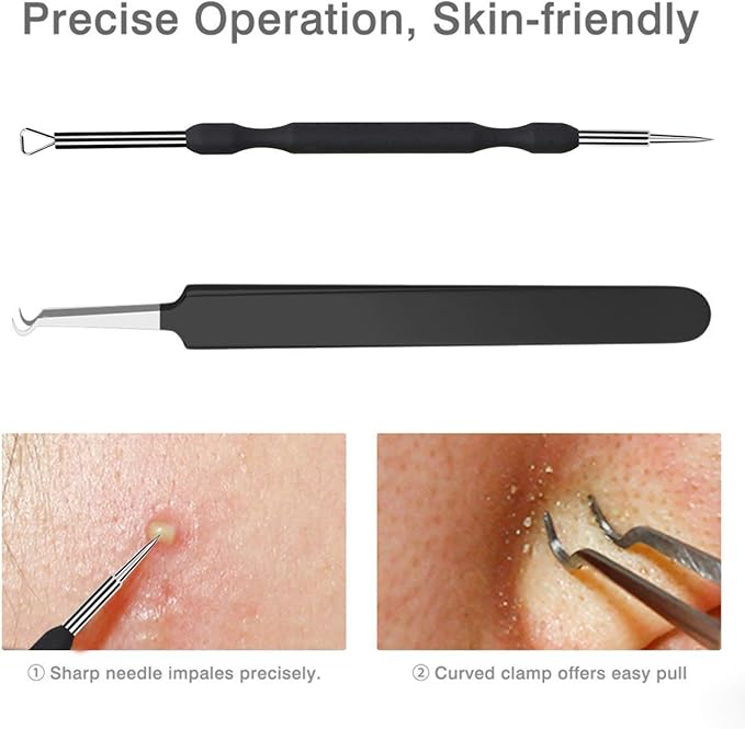 JPNK Blackhead Remover Tool Comedones Extractor Acne Removal Kit for Blemish, Whitehead Popping, 6 Pcs Zit Removing for Nose Face Tools with a Leather Bag (Black)