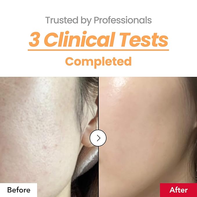 Skin Texture Booster 214% Essence – Deep Hydration, Glass Skin, Triple Hyaluronic Acid, Collagen & Retinol, Lightweight & Non-Sticky, Visibly Plumping Effect, Korean Skincare, 5.07 fl oz