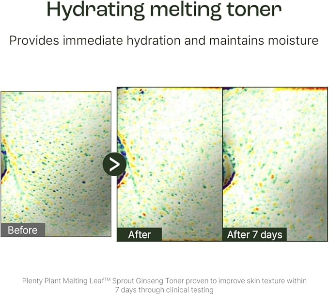 Plentyplant Melting Sprout Ginseng Face Toner, Beauty of Ginseng Essence Water Hydrating Face Toner for Oily and Aging Skin, Korean Moisturizing Skin Care for Men and Women 150ml, 5 fl.oz