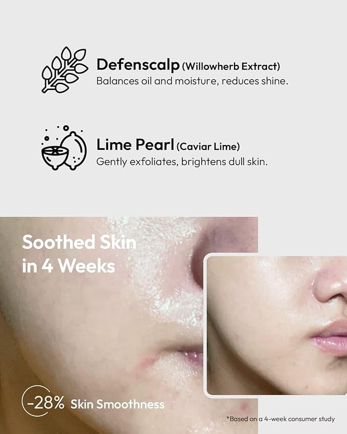 Niacinamide 5% Pore Refining Serum - Minimizes Pores & Controls Oil - for Oily & Sensitive Skin - 1 Fl Oz
