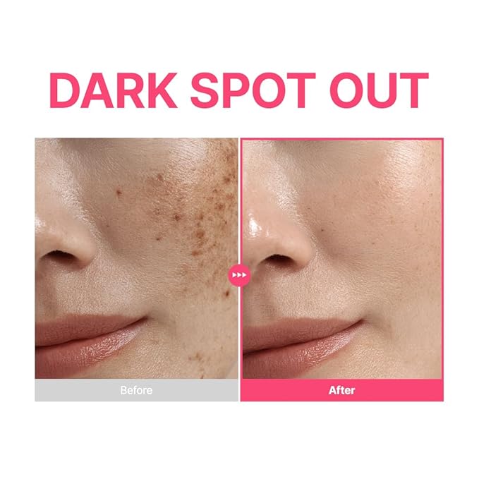 PURITO TXA 6% + Niacinamide 10% + Retinal Facial Serum | for Dark Spots, Hyperpigmentation, Uneven Tone | High-Level Tranexamic Acid 6% | Korean skincare, 30mL 1.01 fl.oz