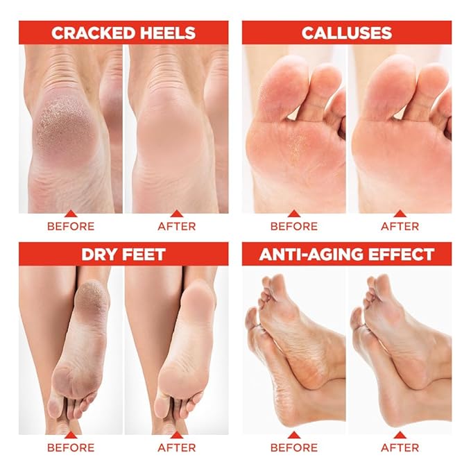 Lavinso Foot Mask that Removes Dead Skin and Callus - 3 Pack - Peach Feet Peeling Mask Extra Strength
