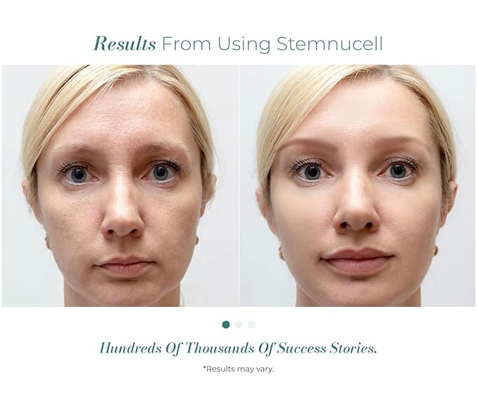 Solvaderm Stemnucell Anti-Aging Facial Serum – Reduces Wrinkles, Fine Lines & Expression Lines – Plant Stem Cells, Peptides & Hyaluronic Acid – Firming, Hydrating Cream for All Skin Types