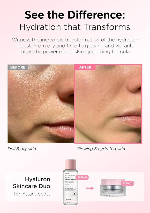Hanskin Pink Hydration Duo – Hyaluron Skin Essence & Moisture Cream | Deep Moisture & Soothing Care for Dry, Sensitive Skin | Lightweight Glow Set for Radiant, Dewy Glass Skin | K-Beauty