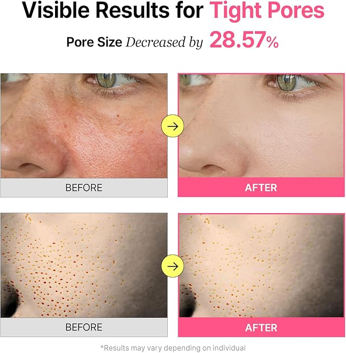 Pore Refining Toner Pad for All Skin Types, Sebum Control, Tighten Pores, Korean Skin Care, Vegan (70 Pads)