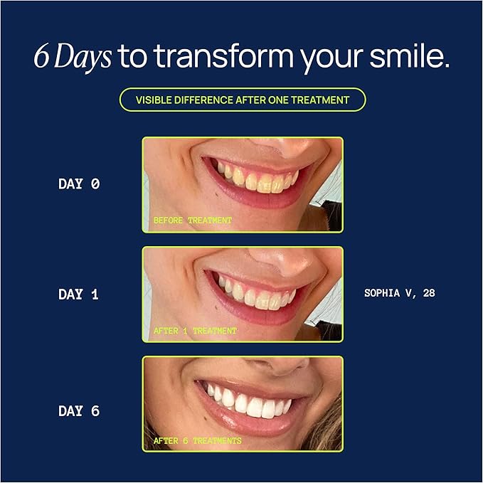Laughland Gentle Teeth Whitening Gel 3 Pack, Tooth Whitener, Made with Sodium Bicarbonate, Glycerin, Aloe Vera & Mint, Gentle on Sensitive Teeth, at Home Dental Care, Travel Friendly, 6 Treaments