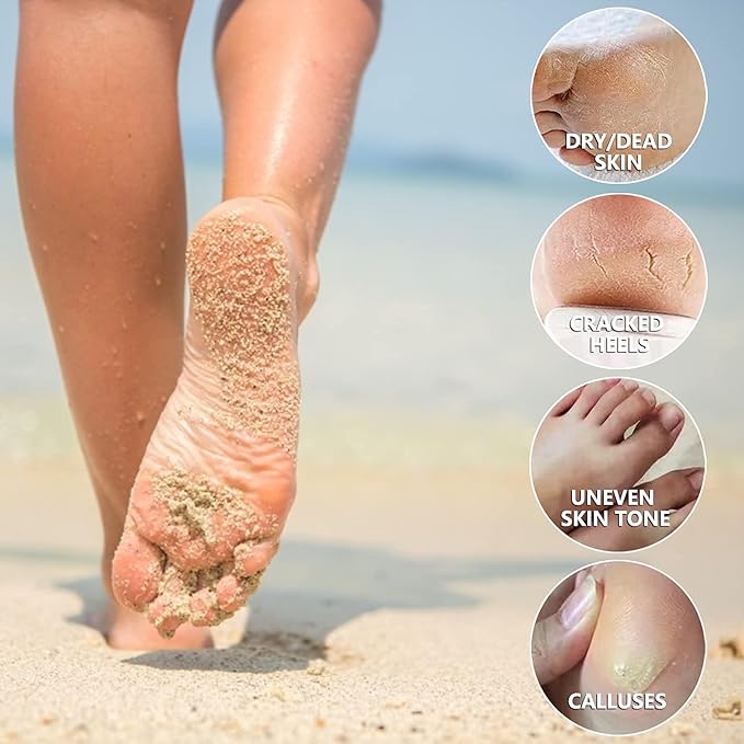 5 Pack Foot Peeling Mask,Exfoliator Peel Off Calluses Dead Skin Callus Remover,Foot Mask for Dry Cracked Feet,Foot Peel Masks for Men and Women Feet Peeling Mask for Stocking Stuffers
