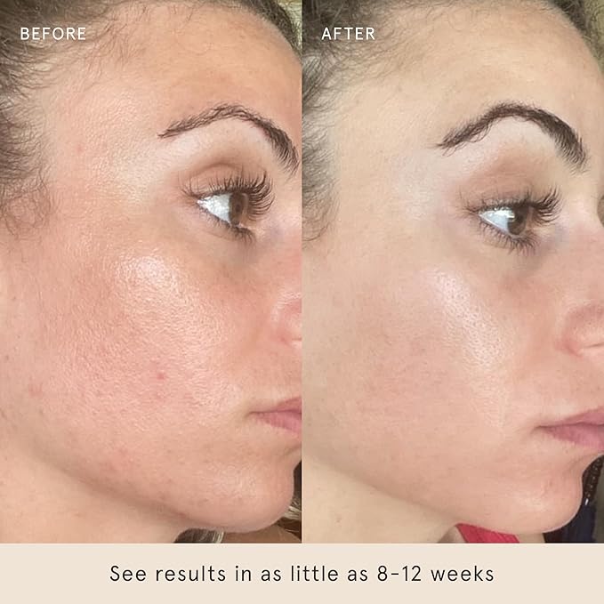 Barefaced Bright Skin Routine - Toning Pads, Brightening Serum, Liquid Gold, & Hydrating Lotion for Smoother, Brighter Skin