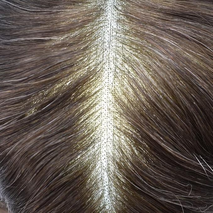 FACE MIRACLE Mens Toupee Lace Front Hairpieces Soft Human Hair Replacement System Natural Hairline Toupee for Men French Lace Poly V-Looped Mens hair Units 7"X9" #310 Dark Brown with 10% Gray