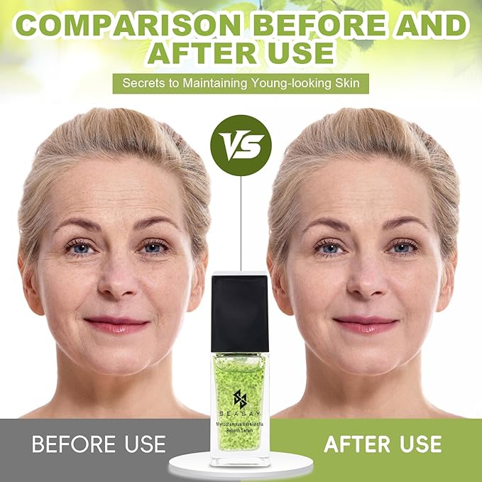 SEASAM Myrothamnus Flabellifolius Rebirth Serum - Premium Revitalizing Green key Essence for Anti-Aging & Repair Plant Extract (30ml)