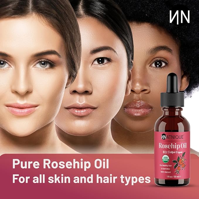 Natnique Organic Rosehip Seed Oil, 1 oz – USDA Certified Cold-Pressed Moisturizer for Face, Skin & Hair – Natural Hydrating Serum for Wrinkles & Fine Lines – Ideal for Gua Sha Massage & Radiant Glow