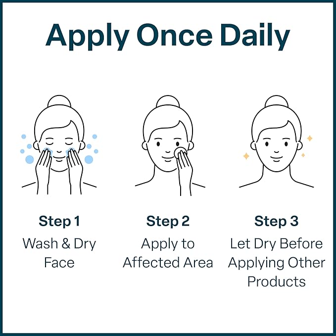 QRxLabs Salicylic & Glycolic Acid Pads (2% Salicylic & 10% Glycolic) - 50 Count Jar - Exfoliating Pads for Acne & Bacne Treatment with Vitamins B5, C & E & Calendula & Green Tea