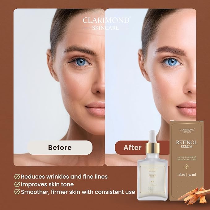 CLARIMOND Retinol Serum for Face – 1% Resurfacing Retinol and Hyaluronic Acid Serum with Niacinamide & Aloe Vera for Anti-Aging, Brightening, Wrinkle Reduction & Dark Spot Treatment