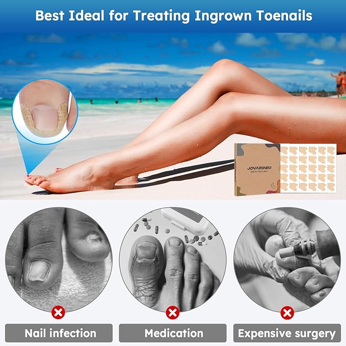 Ingrown Toenail Treatment, No Glue Breathable Curved Toenail Corrector，Ingrown Toenail Corrector Strips with File and Lifter, Professional Nail Correction Stickers 60Pcs