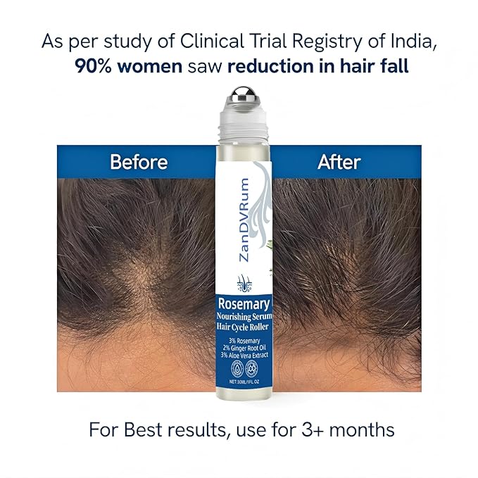 Rosemary Hair Growth Serum Roll-On for Thinning Hair with Saw Palmetto & Tea Tree — Lightweight, Non-Greasy Scalp Oil for Hair Regrowth Support