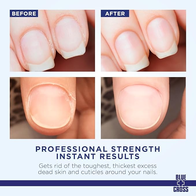 Blue Cross Professional Nail + Cuticle Care 2 Pack Bundle, Liquid Cuticle Remover + Softener & Cuticle Nippers, Cutter & Trimmer for Fingernails and Toenails