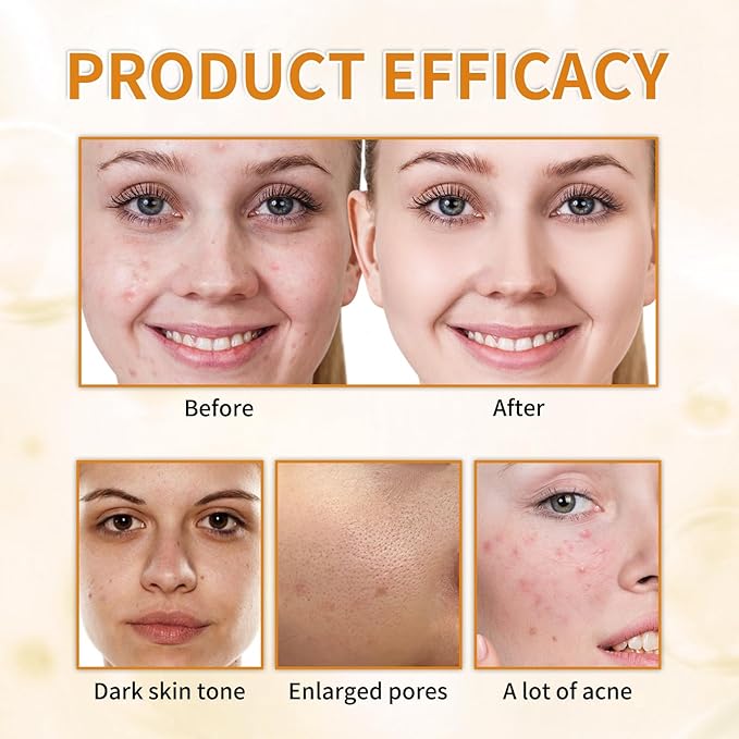 7% Glycolic Acid Exfoliating Toner, Exfoliating Facial Toner, Pore Minimizing Toner, Smooth Skin, Even Tone, Hydrating Formula