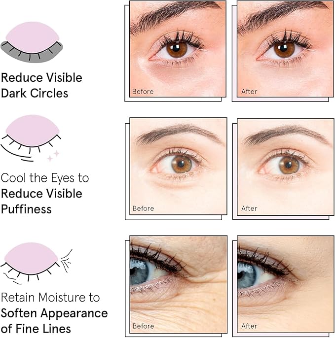 grace & stella Award Winning Under Eye Mask Reduce Dark Circles, Puffy Eyes, Undereye Bags, Wrinkles, Gel Under Eye Patches, Birthday Gifts for Women - Vegan Cruelty-Free Self Care (48 Pairs, Blue)