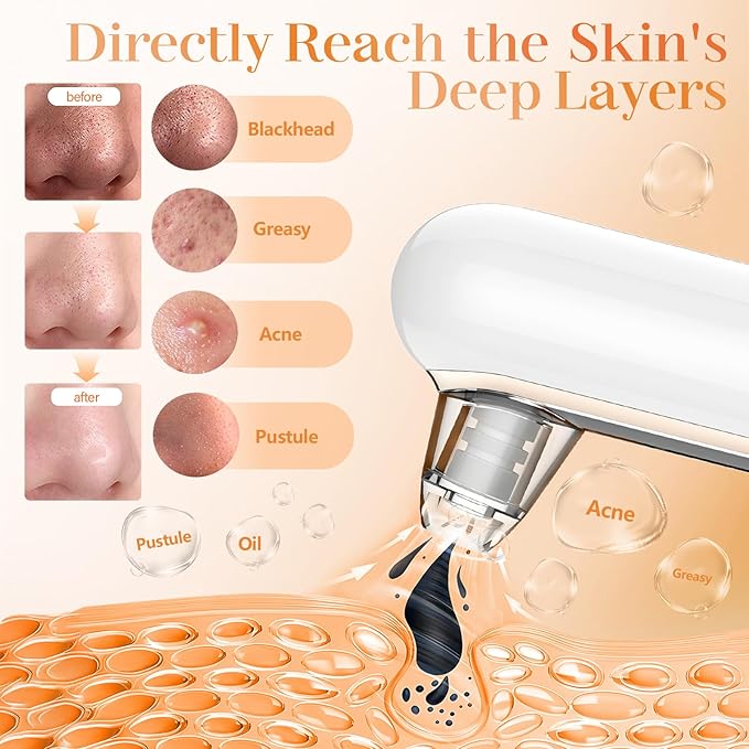 Yccu Blackhead Remover Vacuum Pore Extractor Black Head Remover for Face Blackhead Extractor Pore Vacuum Pimple Extractor Skin Tag Remover Tool Pore Cleaner with USB Charge 4 Modes 5 Suction Heads